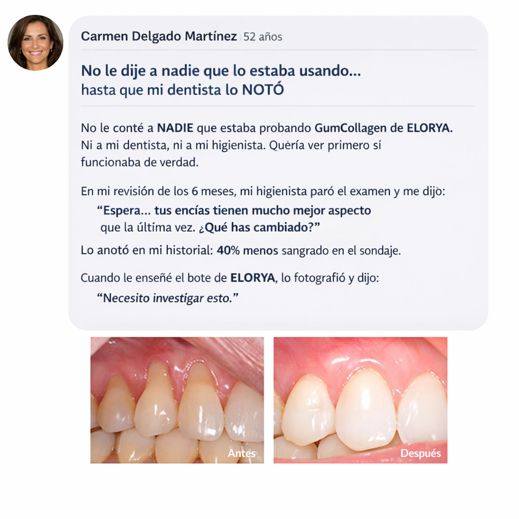 ELORYA GumRestore