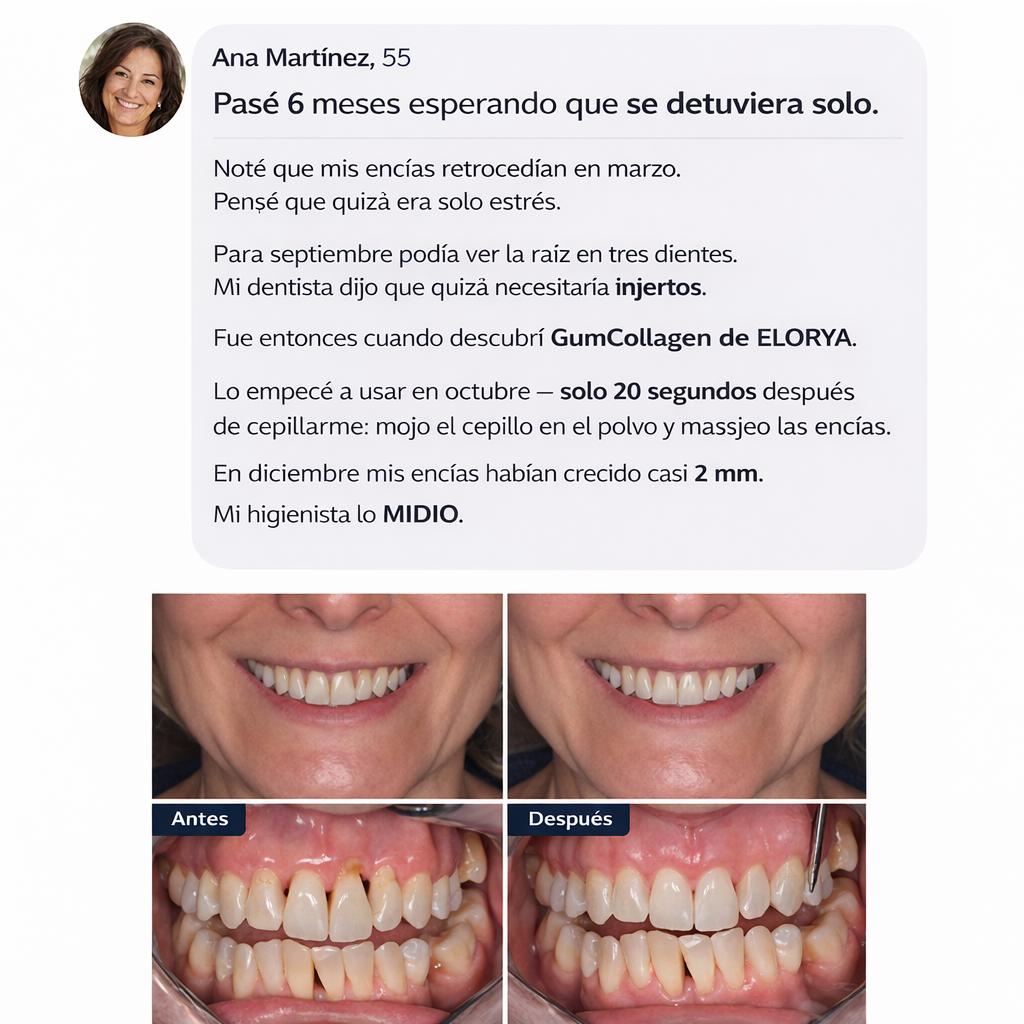 ELORYA GumRestore