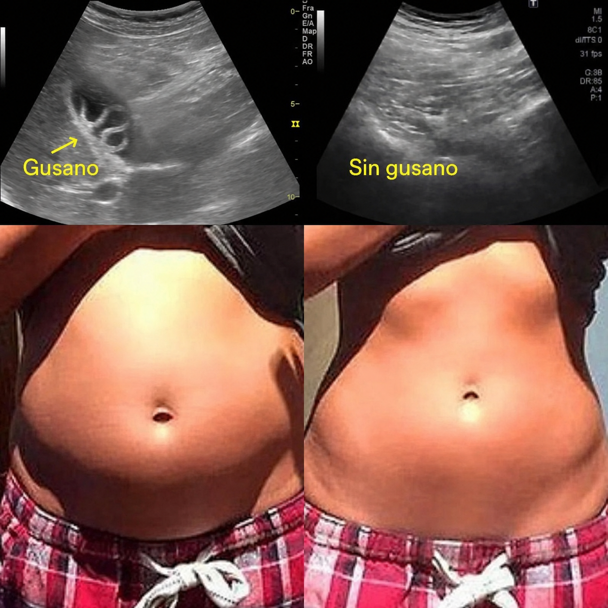 ELORYA™ Faja Detox de Ricino