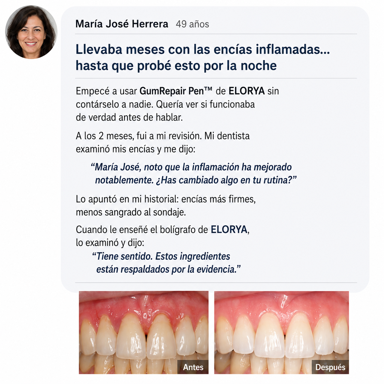 ELORYA GumRepair Pen