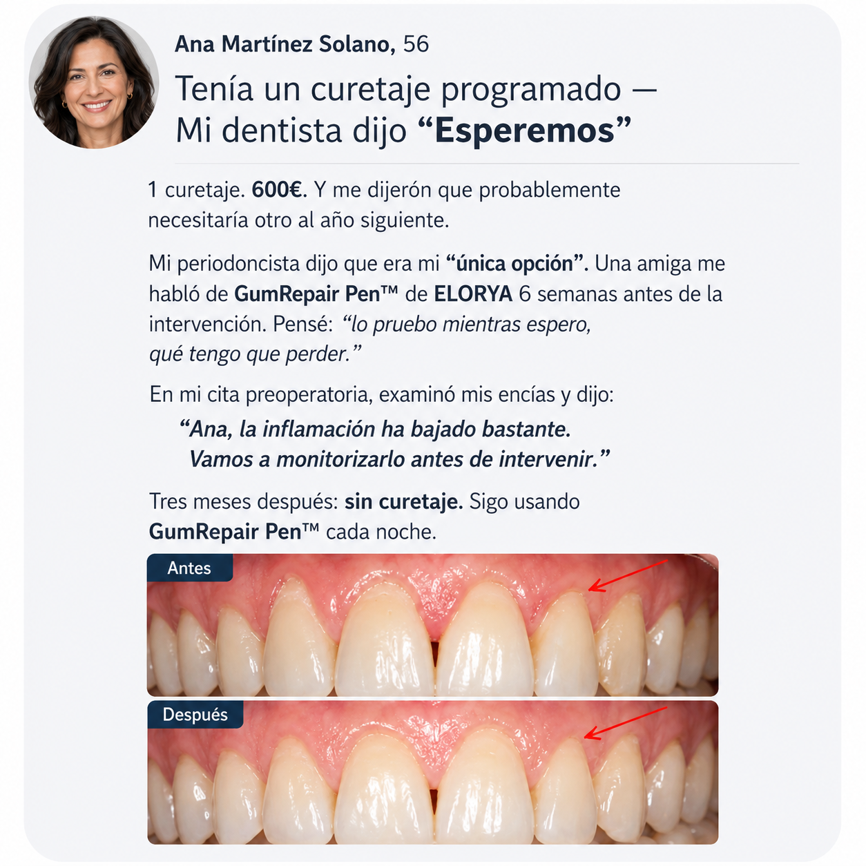 ELORYA GumRepair Pen