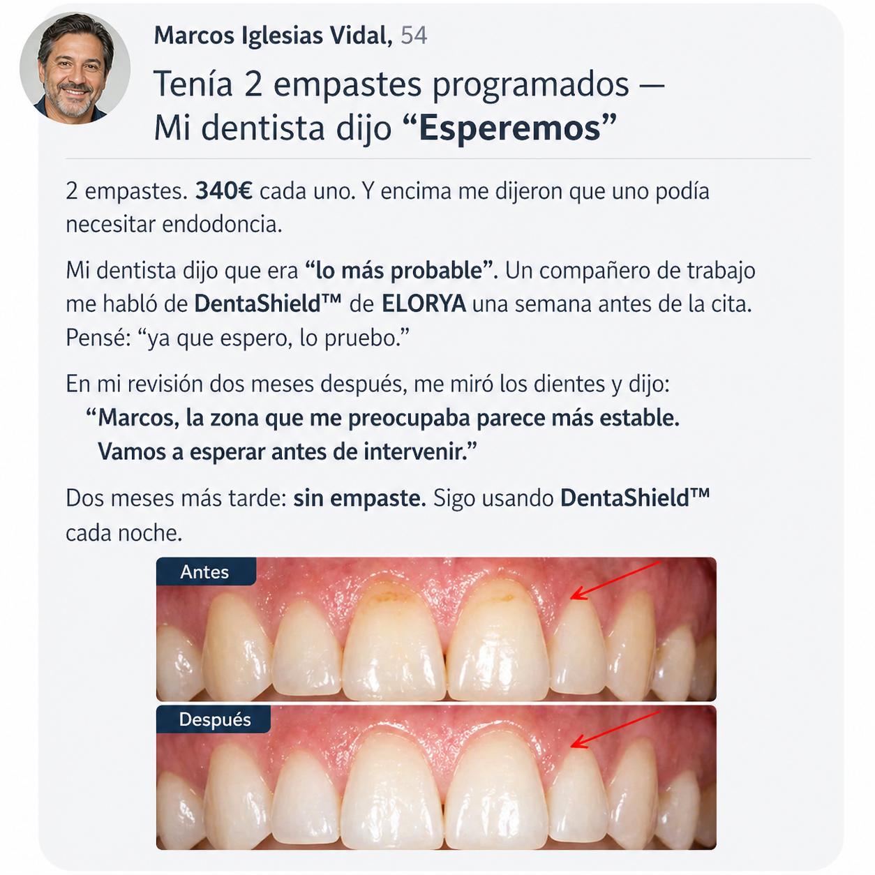 ELORYA DentaShield