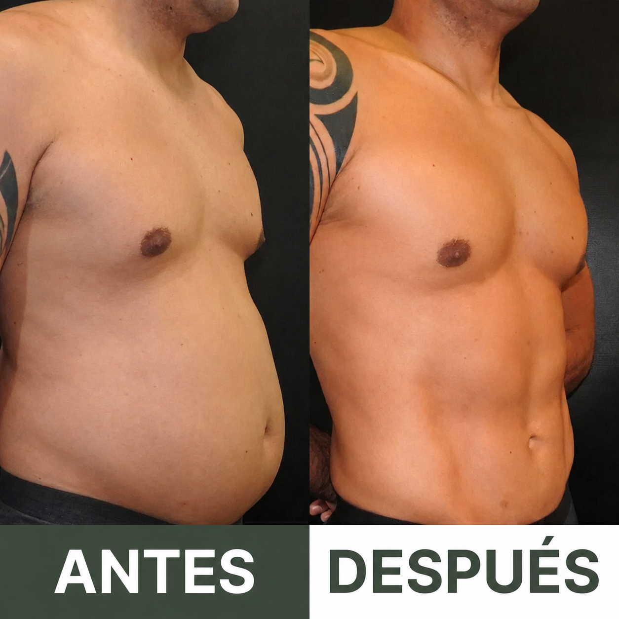 ELORYA™ Faja Detox de Ricino