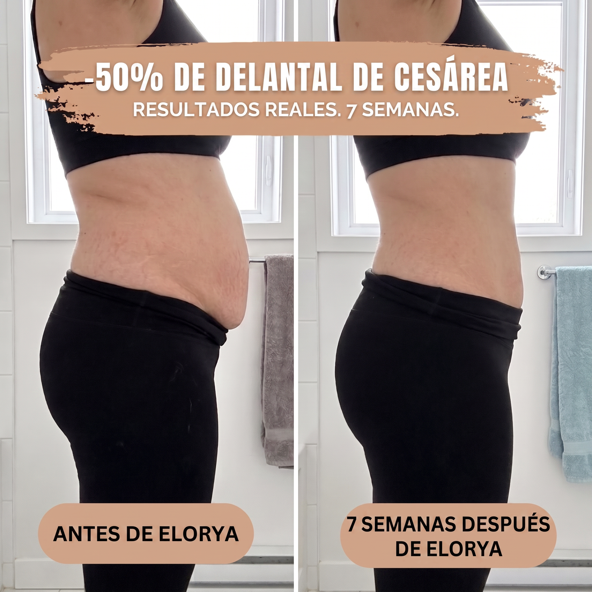 Braguita Moldeadora Post-Parto — Compresión 360°